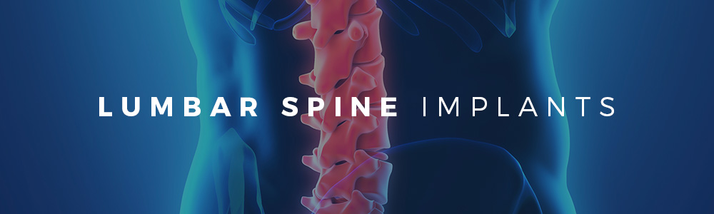 Lumbar Spine Implants